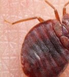 25 Best Home Remedies and Ways to Get Rid of Ticks