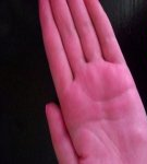 What to do if the mud began to paint the hands, how to fix it