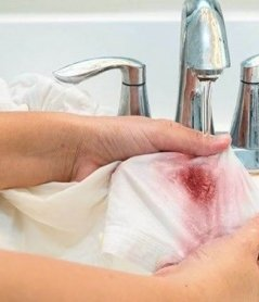 Rules and 10 Best Methods to Get Rid of Plum Spot Fast