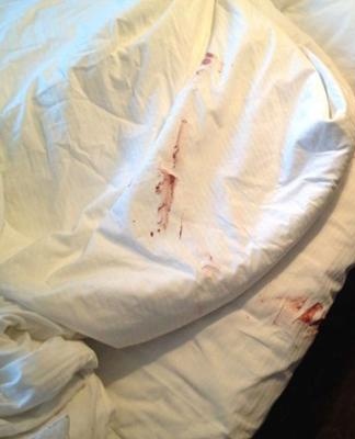 blood on the white bed