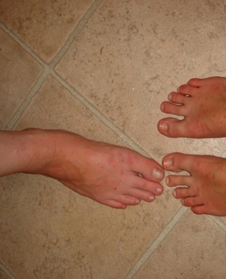 fleas in the apartment