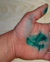 How to quickly wash off shiny green from the skin, 25 ways to remove it with chemistry and folk remedies