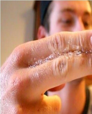 The main advantage of the method is that there is oil in every refrigerator.