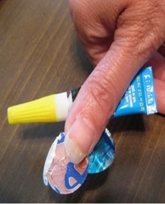 If the adhesive does not separate from the skin the first time, try again.