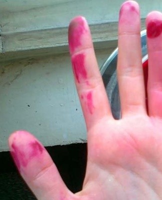 A tight cotton swab is moistened in a disinfectant and the red spots of Fukortsin are carefully removed.