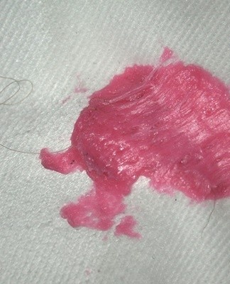 Depending on the type of fabric on which plasticine fell, approaches to the process of cleaning problem areas change.