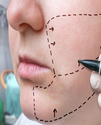 To remove traces of the marker, you need to take 1 tablespoon of salt and dilute with water to a boiled state.