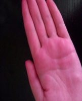 What to do if the mud began to paint the hands, how to fix it