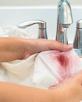 Rules and 10 Best Methods to Get Rid of Plum Spot Fast