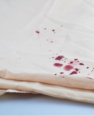 When using stain removers, certain rules must be observed.