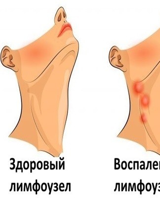 lymph nodes