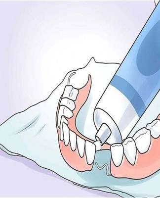 To fill a crack in a prosthesis, dental technicians systematically perform a number of actions.