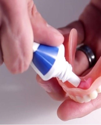 Dental constructions can be restored using adhesive solutions.